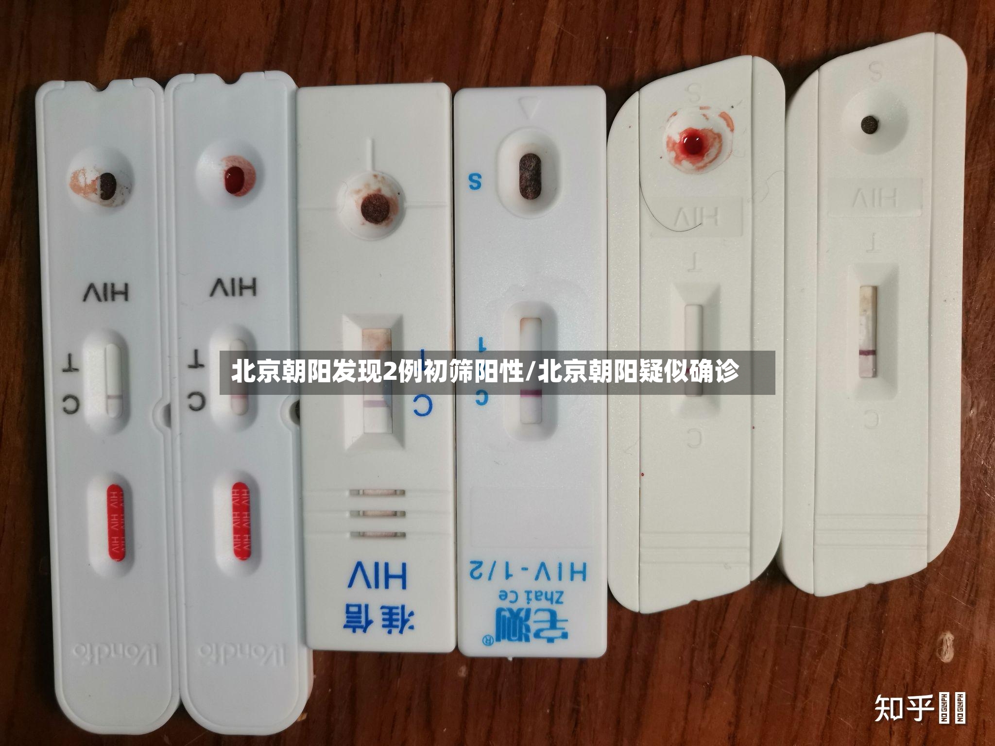 北京朝阳发现2例初筛阳性/北京朝阳疑似确诊-第2张图片