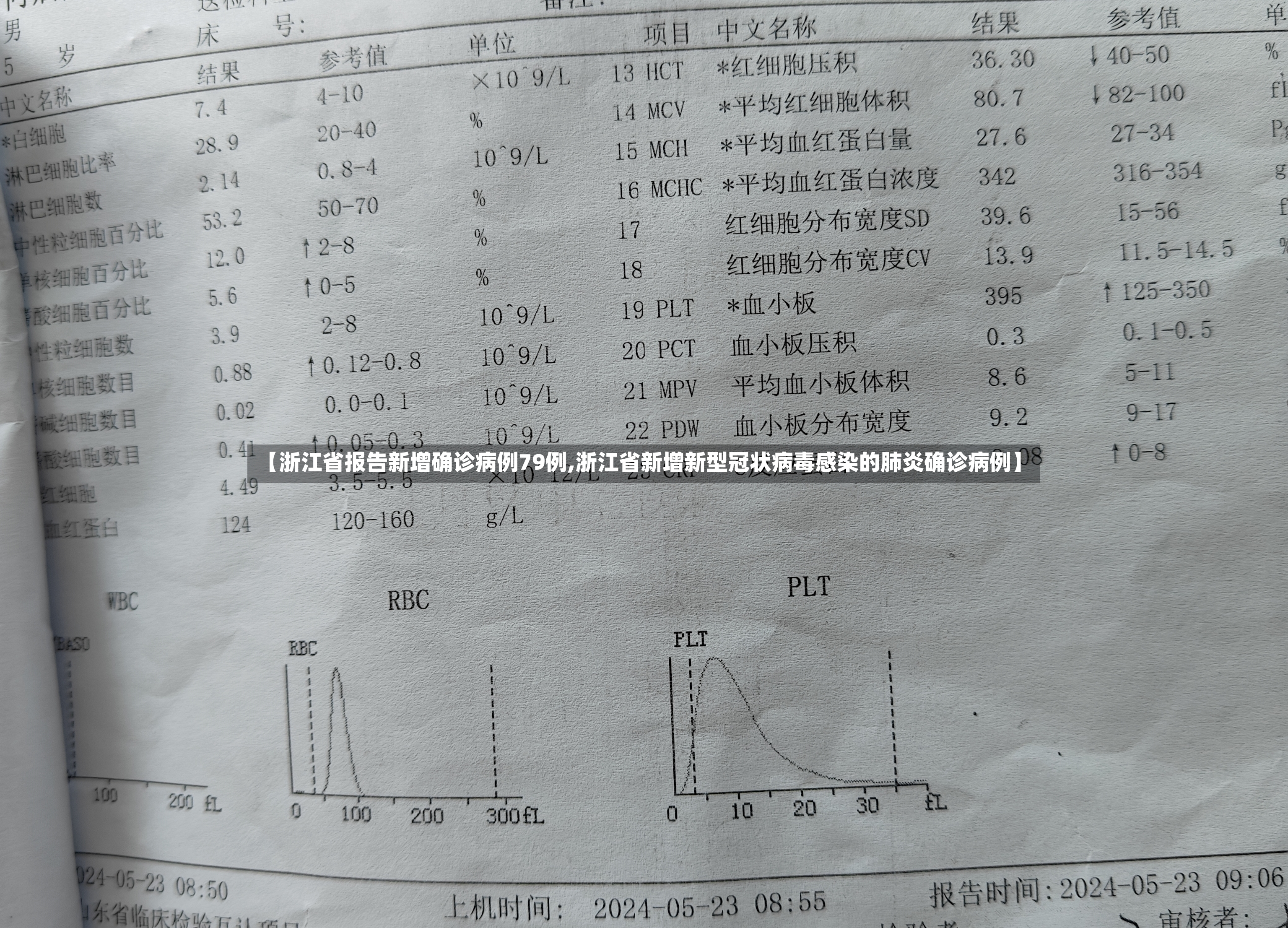 【浙江省报告新增确诊病例79例,浙江省新增新型冠状病毒感染的肺炎确诊病例】