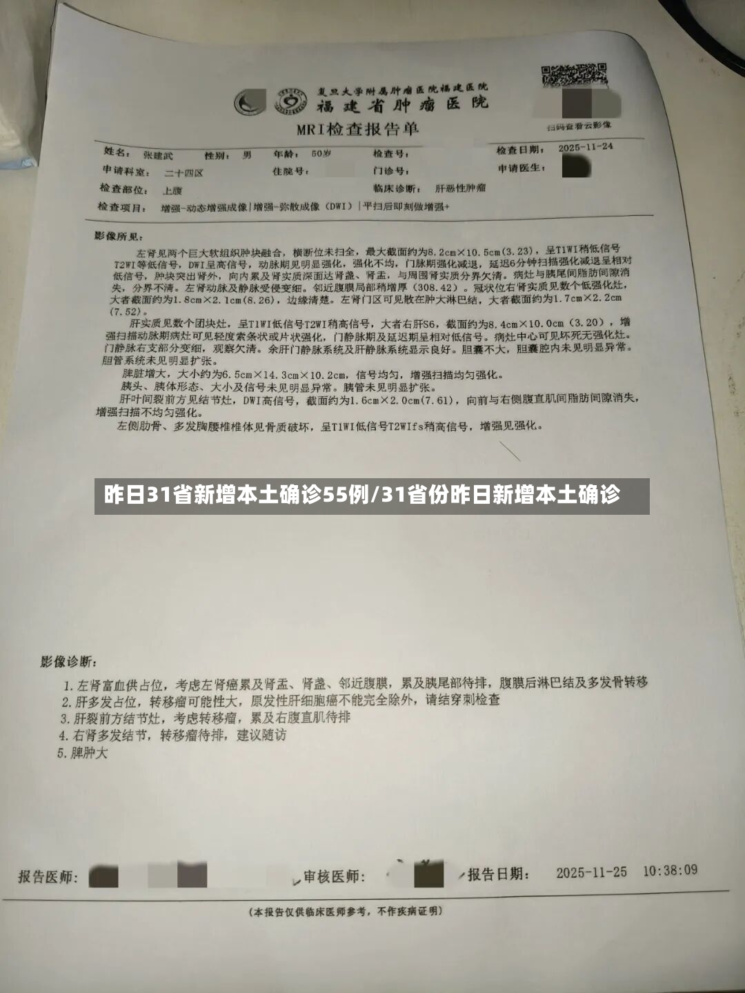 昨日31省新增本土确诊55例/31省份昨日新增本土确诊-第2张图片