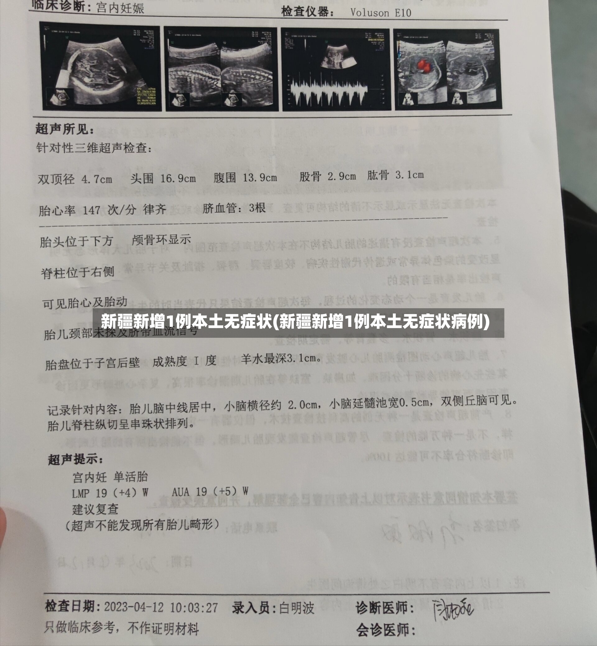 新疆新增1例本土无症状(新疆新增1例本土无症状病例)