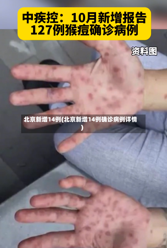 北京新增14例(北京新增14例确诊病例详情)