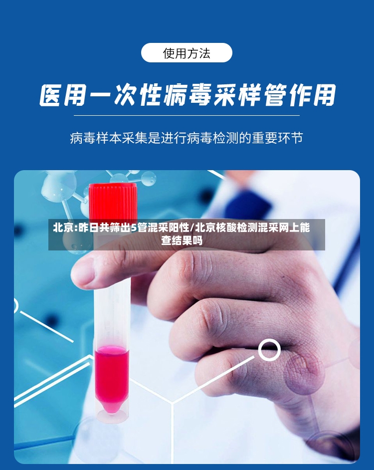 北京:昨日共筛出5管混采阳性/北京核酸检测混采网上能查结果吗-第2张图片