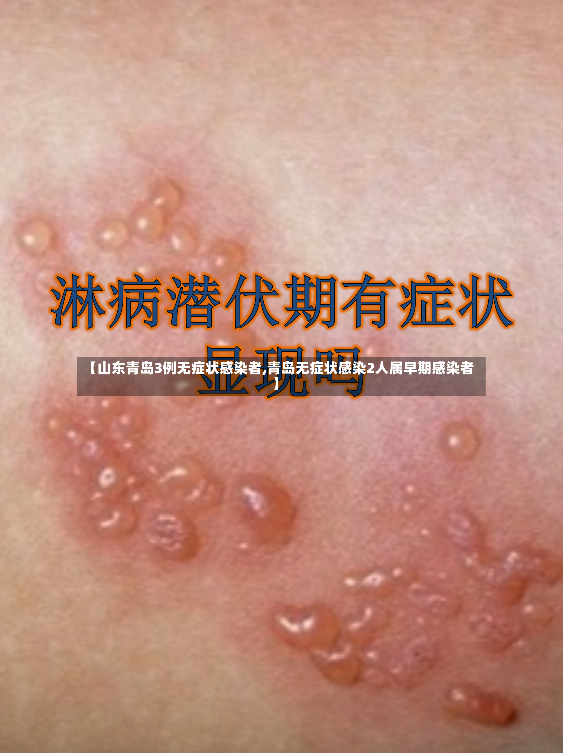 【山东青岛3例无症状感染者,青岛无症状感染2人属早期感染者】-第2张图片