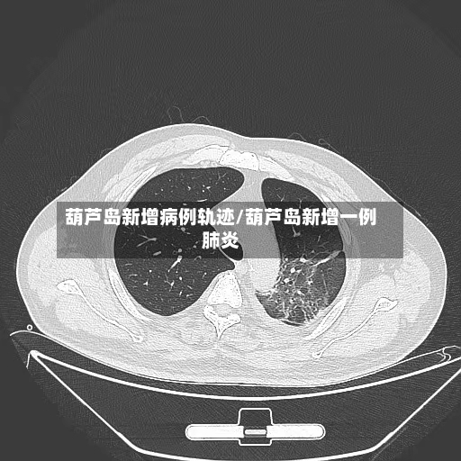葫芦岛新增病例轨迹/葫芦岛新增一例肺炎