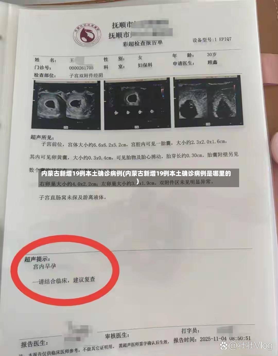 内蒙古新增19例本土确诊病例(内蒙古新增19例本土确诊病例是哪里的)-第2张图片