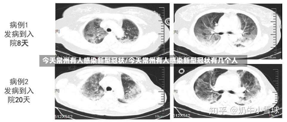 今天常州有人感染新型冠状/今天常州有人感染新型冠状有几个人-第3张图片