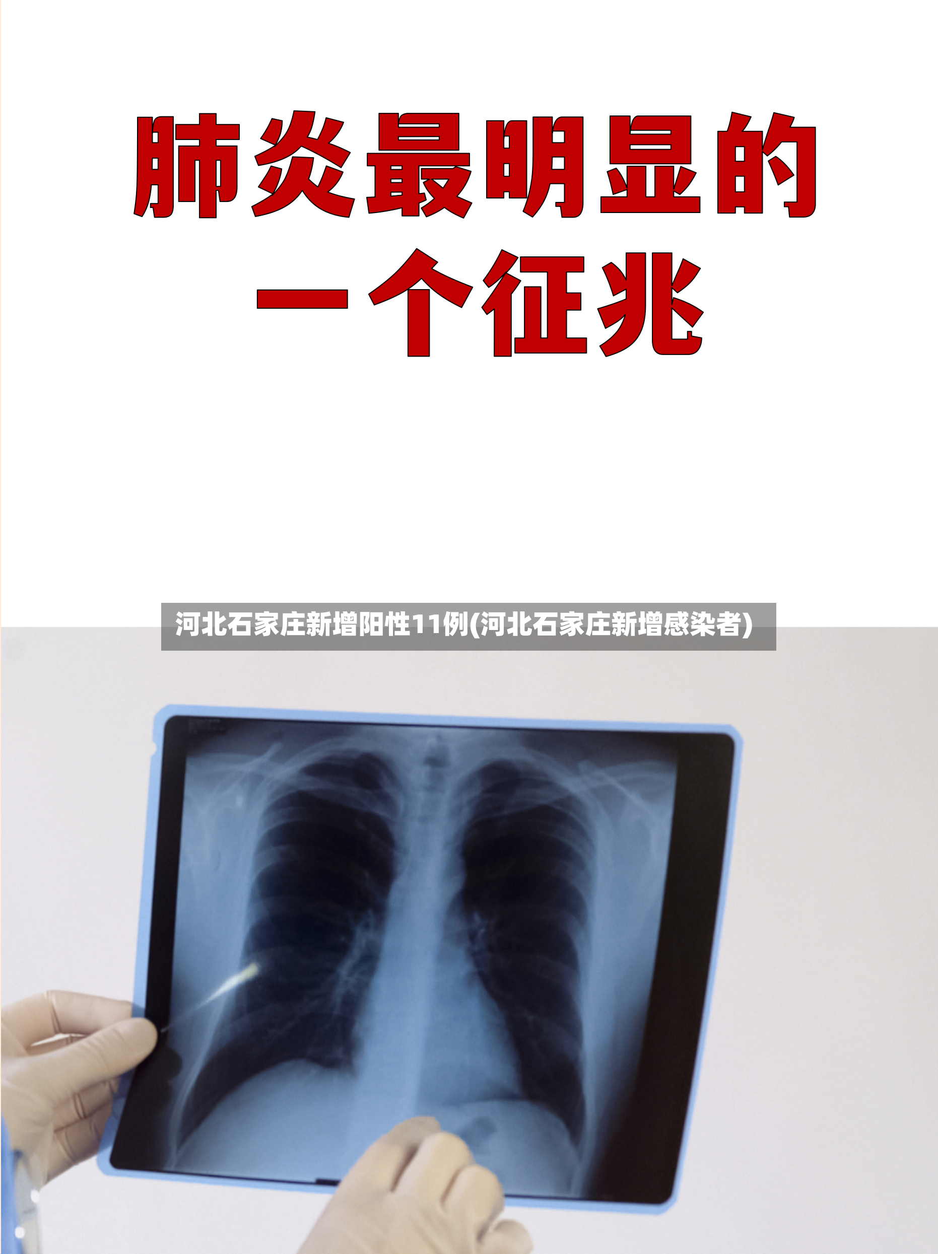 河北石家庄新增阳性11例(河北石家庄新增感染者)